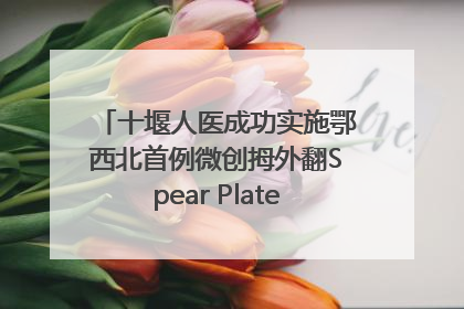 十堰人医成功实施鄂西北首例微创拇外翻Spear Plate髓内板矫形术